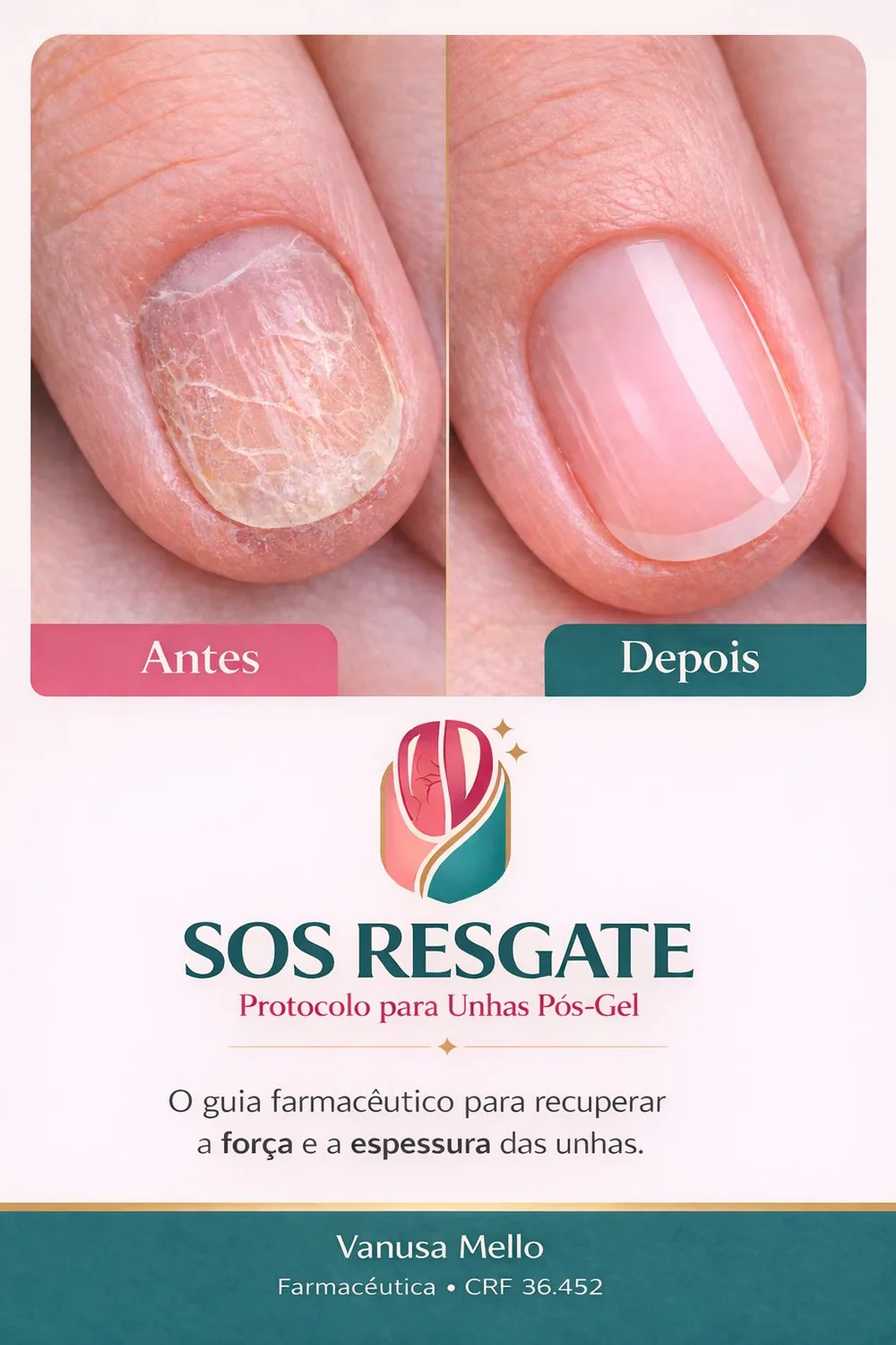 Capa do protocolo SOS Resgate Unhas Pós-Gel